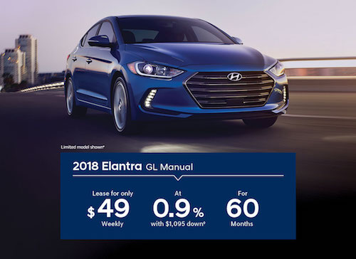 2018 Hyundai Elantra Lease Special 2018 Hyundai Elantra Lease Special